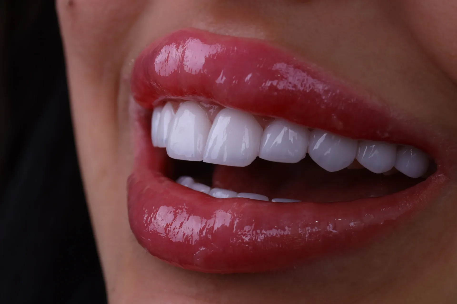 Alanya Dental Place hero background